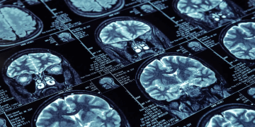 Medical Image Analysis: Revolutionizing Healthcare with Technology