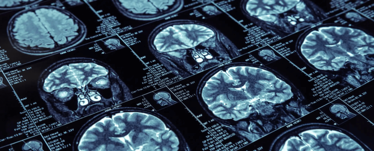 Medical Image Analysis: Revolutionizing Healthcare with Technology